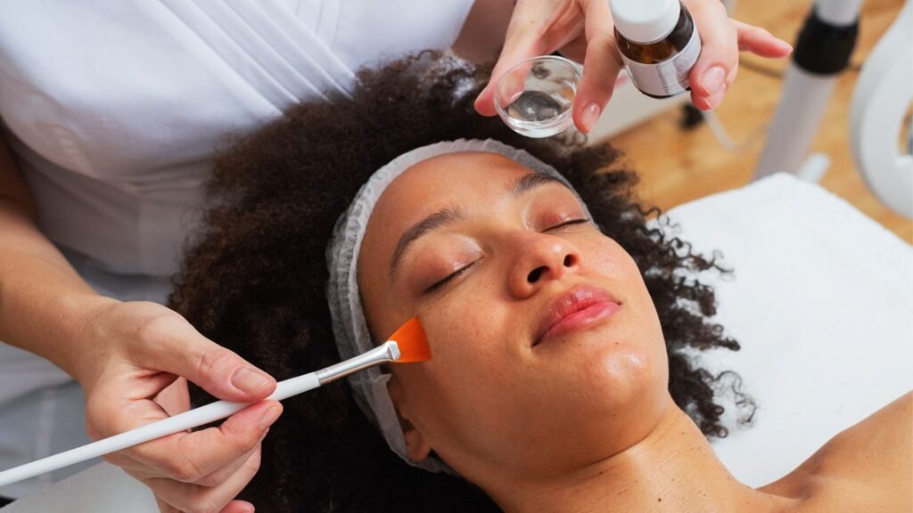 What to Expect After a Chemical Peel: Results, Recovery, and Skin Benefits